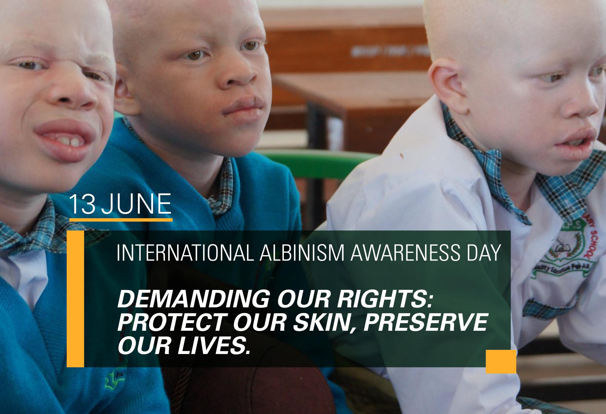 International Albinism Awareness Day Statement 2025