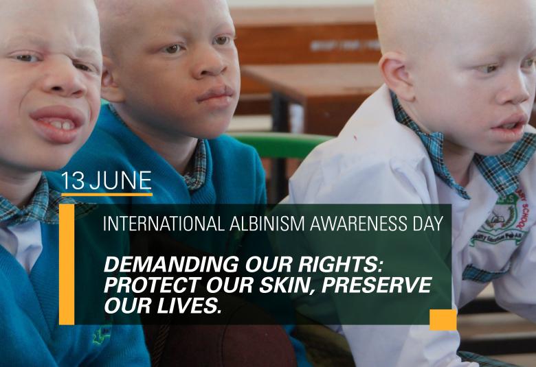 International Albinism Awareness Day Statement 2025