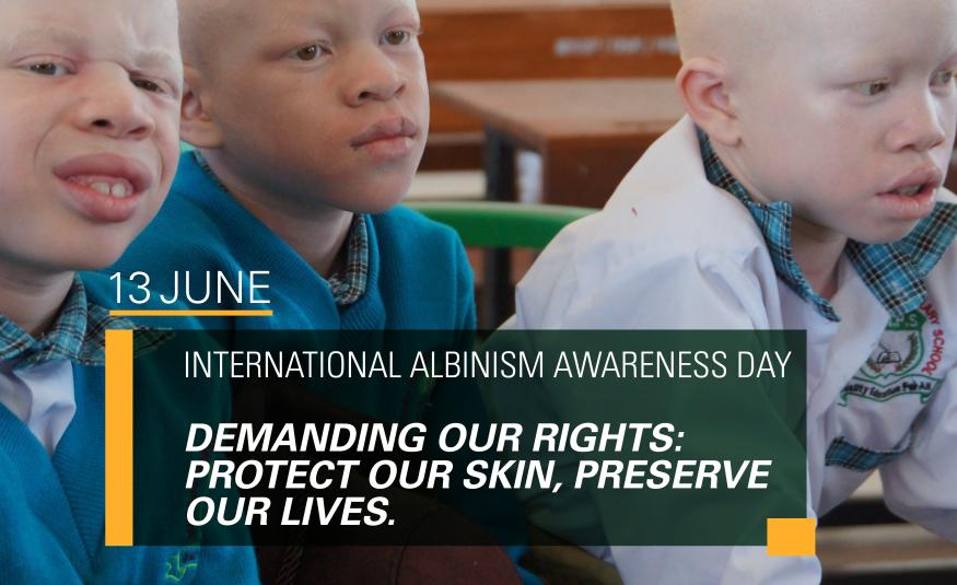 International Albinism Awareness Day Statement 2025