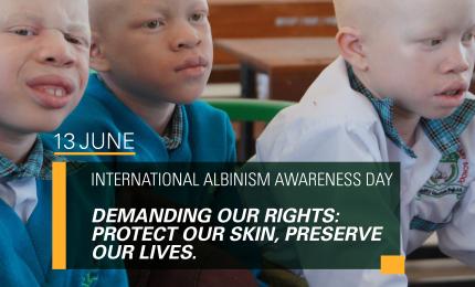 International Albinism Awareness Day Statement 2025